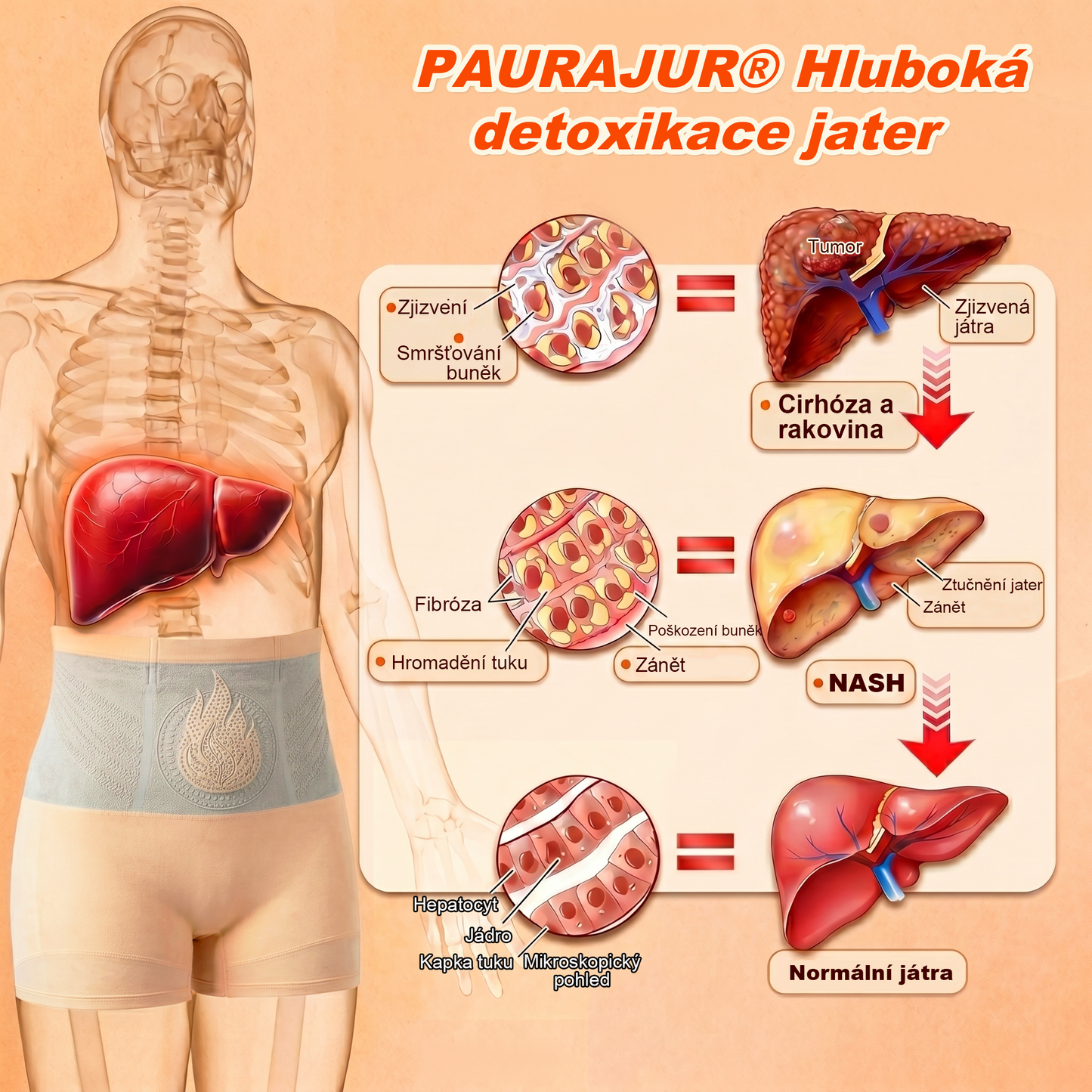 PAURAJU® 4v1 tvarující šortky s mikročásticovou technologií – stačí 30 minut denně 🍒🍒