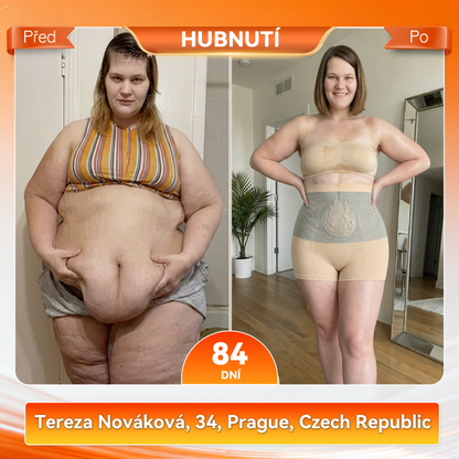 PAURAJU® 4v1 tvarující šortky s mikročásticovou technologií – stačí 30 minut denně 🍒🍒