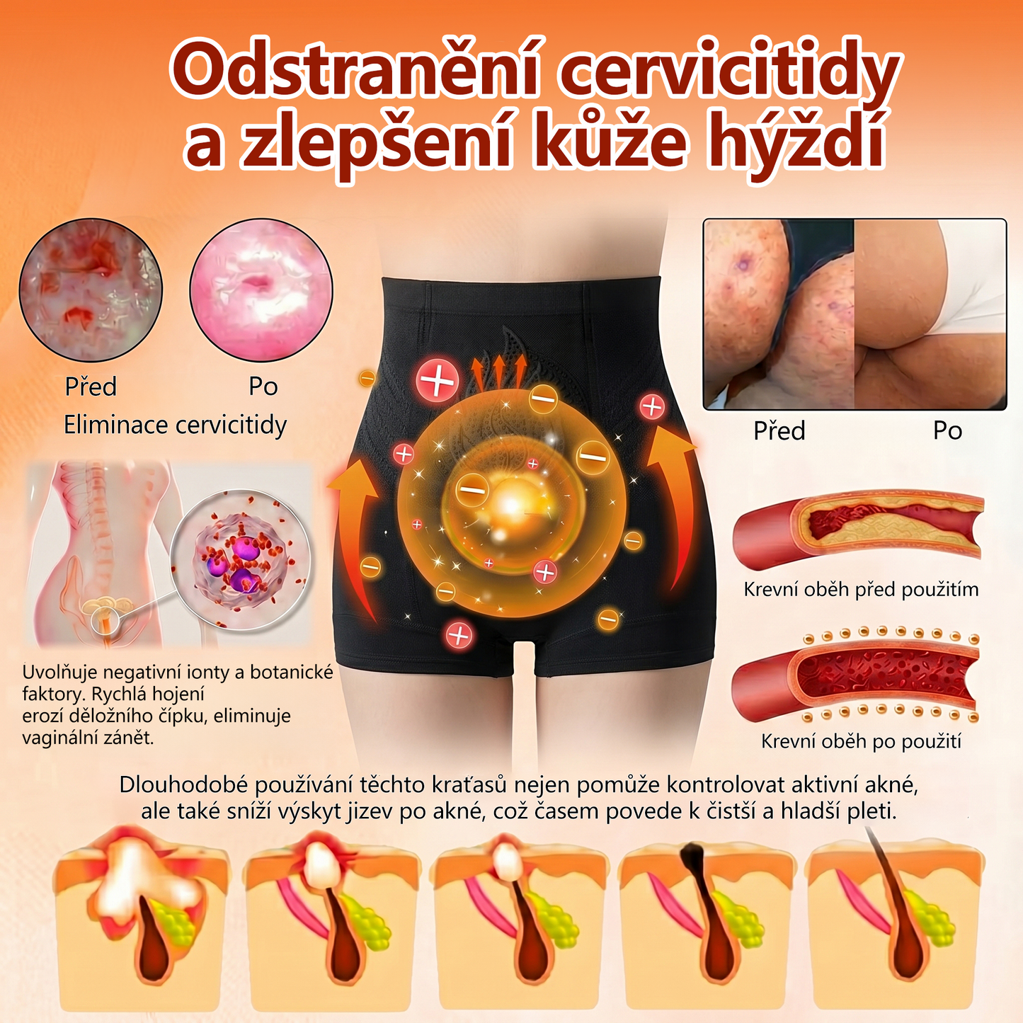 PAURAJU® 4v1 tvarující šortky s mikročásticovou technologií – stačí 30 minut denně 🍒🍒