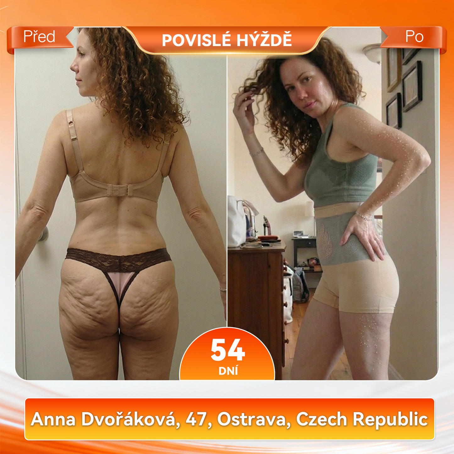 PAURAJU® 4v1 tvarující šortky s mikročásticovou technologií – stačí 30 minut denně 🍒🍒