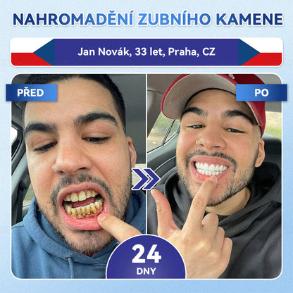 𝐺𝑙𝑖𝑚𝑚𝑒𝑟𝑙𝑦®𝑇𝑖𝑑𝑒𝑔𝑙𝑢𝑠𝑖𝑏 𝑍𝑢𝑏𝑦 𝑎 𝐷á𝑠𝑛ě 𝑂𝑝𝑟𝑎𝑣𝑛é 𝑅𝑦𝑐ℎ𝑙𝑒 𝑆𝑒 𝑅𝑜𝑧𝑝𝑜𝑢š𝑡ě𝑗í𝑐í 𝐵ě𝑙í𝑐í 𝑃𝑟𝑜𝑢ž𝑘𝑦  (𝟓-𝐯-𝟏 🦷 𝐎𝐛𝐧𝐨𝐯𝐚 𝐳𝐮𝐛𝐧í 𝐬𝐤𝐥𝐨𝐯𝐢𝐧𝐲 𝐚 𝐝𝐞𝐧𝐭𝐢𝐧𝐮 • 𝐏𝐨𝐬í𝐥𝐞𝐧í 𝐝á𝐬𝐧í • 𝐎𝐝𝐬𝐭𝐫𝐚𝐧ě𝐧í 𝐳𝐮𝐛𝐧í𝐡𝐨 𝐤𝐚𝐦𝐞𝐧𝐞 𝐚 𝐳á𝐩𝐚𝐜𝐡𝐮 • 𝐁ě𝐥𝐞𝐧í • 𝐙𝐚𝐬𝐭𝐚𝐯𝐞𝐧í 𝐜𝐢𝐭𝐥𝐢𝐯𝐨𝐬𝐭𝐢 𝐳𝐮𝐛ů)   蓝包装+4.0 捷克